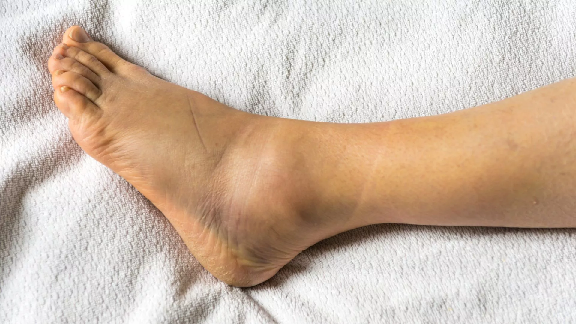 Ankle Injury Rehabilitation Program